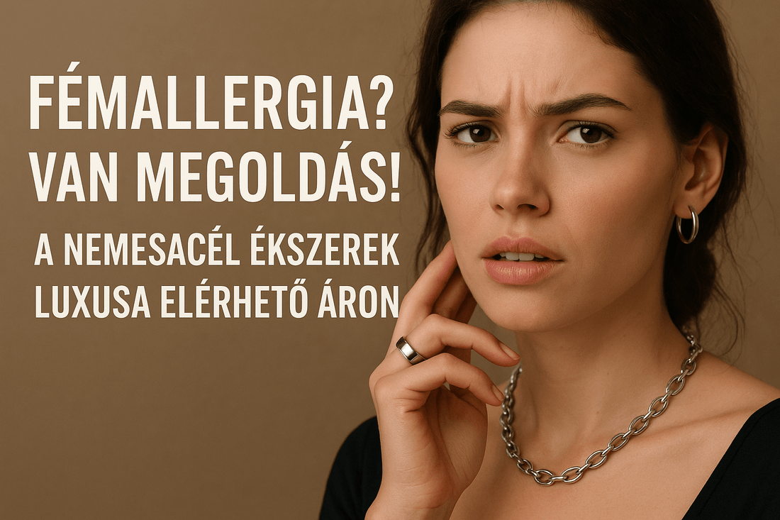 Fémallergia? Van megoldás! A nemesacél ékszerek luxusa elérhető áron. - Ferro Jewelry